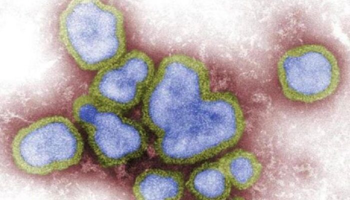 Flu Burung H5N1 Sudah Merambah Ke China, Seorang Wanita Usia 53 Tahun dinyatakan Positif