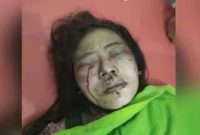 Wanita yang dianiaya teman kenalan nya (dok.ist)